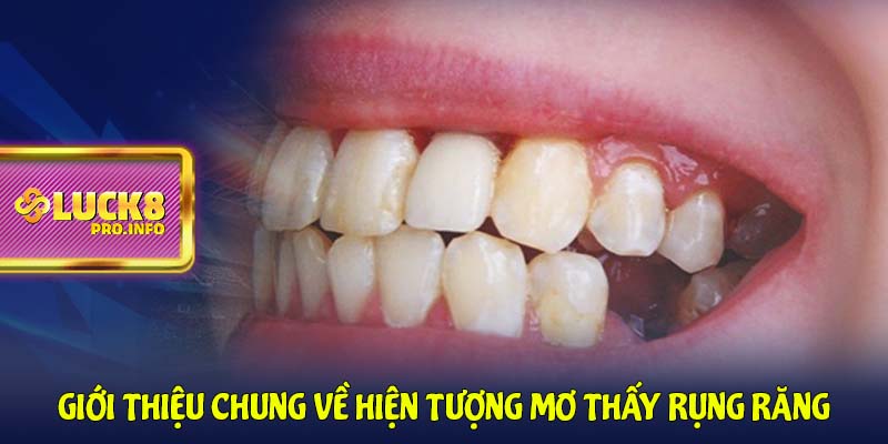 Giới thiệu chung về hiện tượng mơ thấy rụng răng